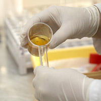 Urinfunktionsdiagnostik - Heilpraktiker - Praxis - Herne Urinfunktionsdiagnostik